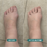 Alyyne Sized Toe Spacer
