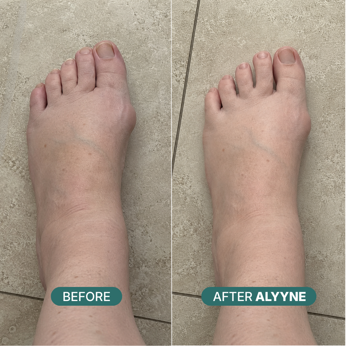 Alyyne Sized Toe Spacer