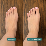 Alyyne Sized Toe Spacer