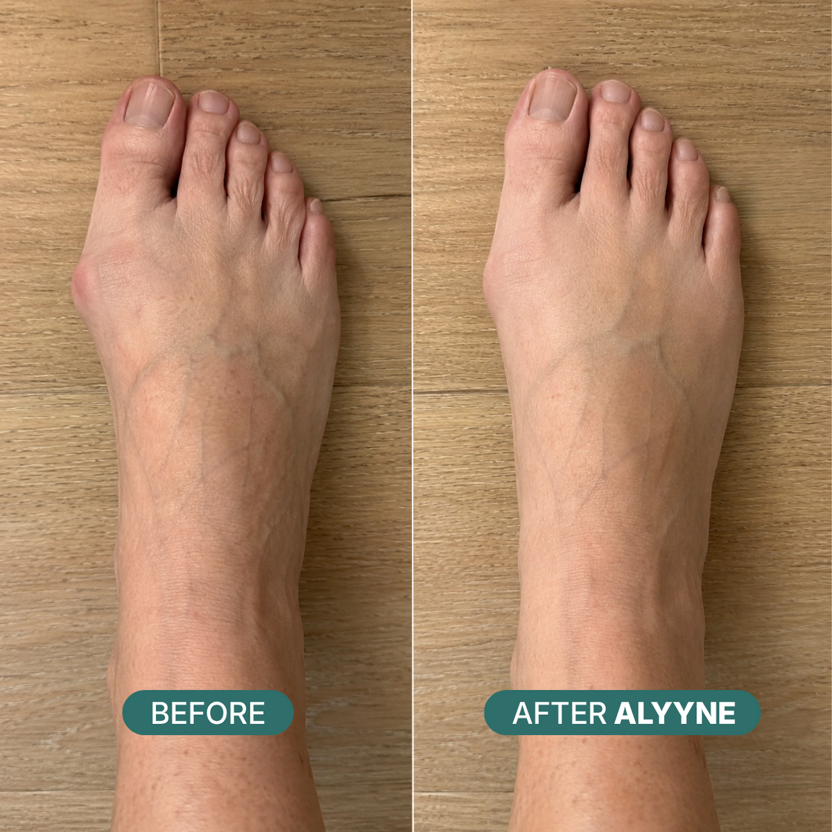 Alyyne Sized Toe Spacer