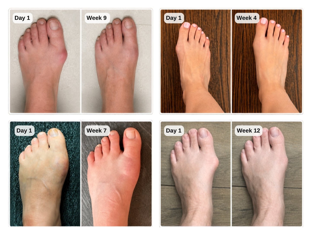 Real Feet. Real Difference.